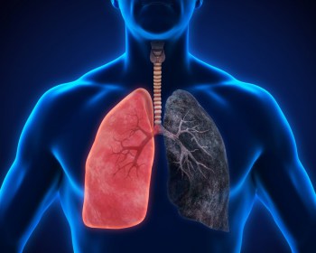 8-síntomas-de-la-pulmonía-que-no-puedes-ignorar